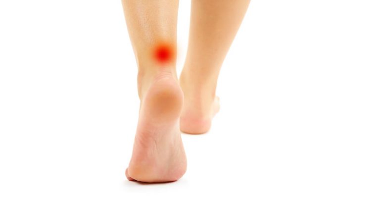achilles tendonitis calf pain treatment